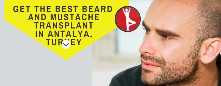 Beard  and Mustache Transplant in Antalya Turkey